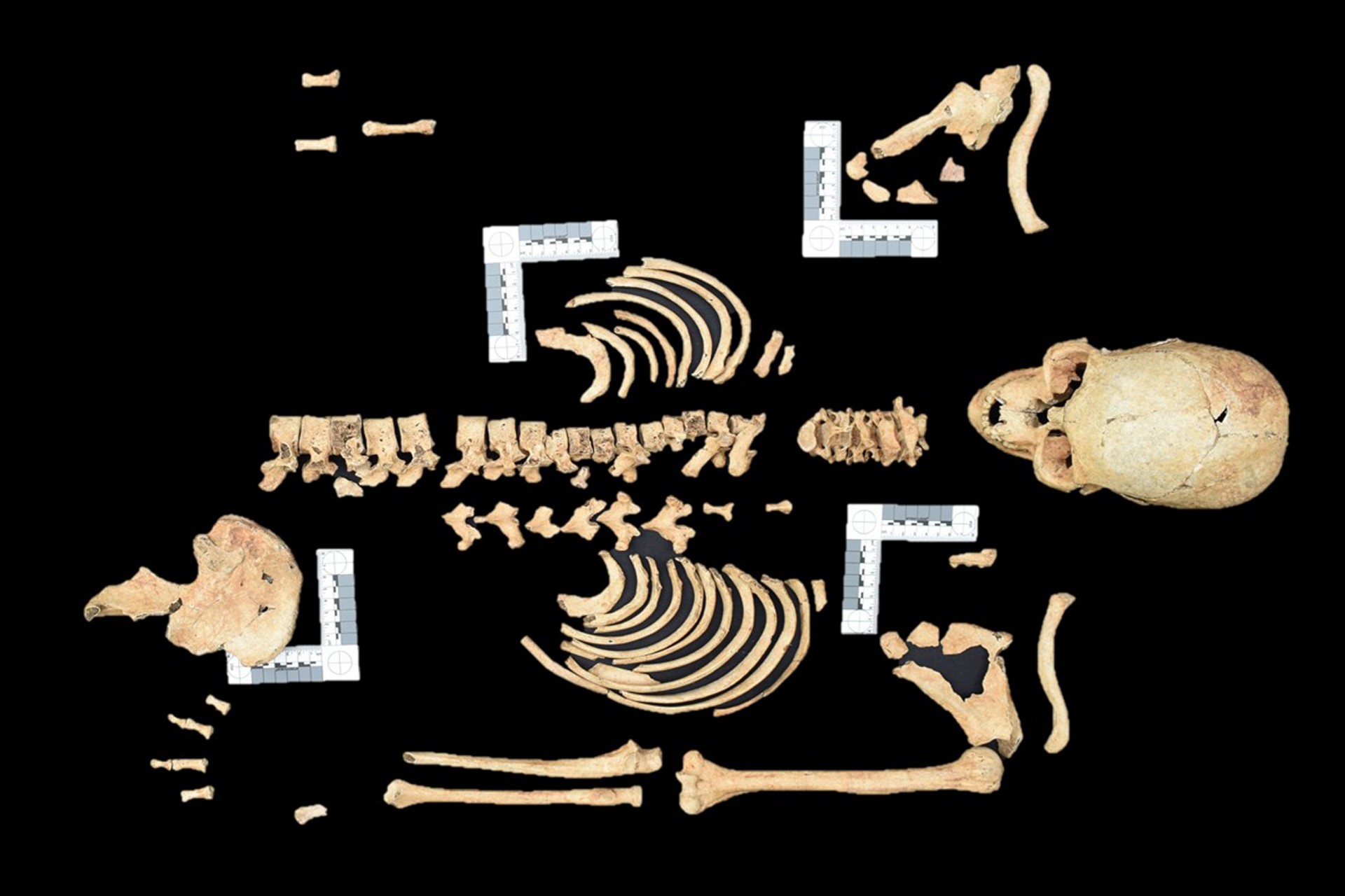 Historia para No Historiadores - Cursos - 😵La típica mandíbula