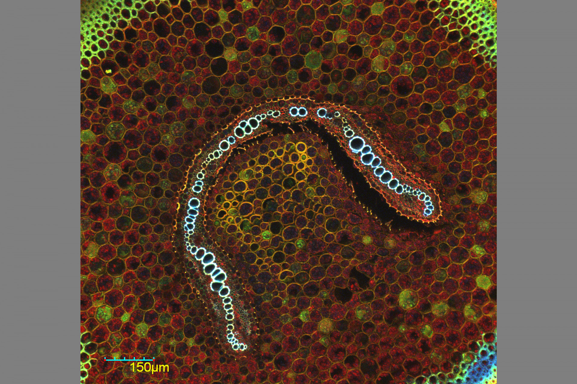 Confocal Microscopy