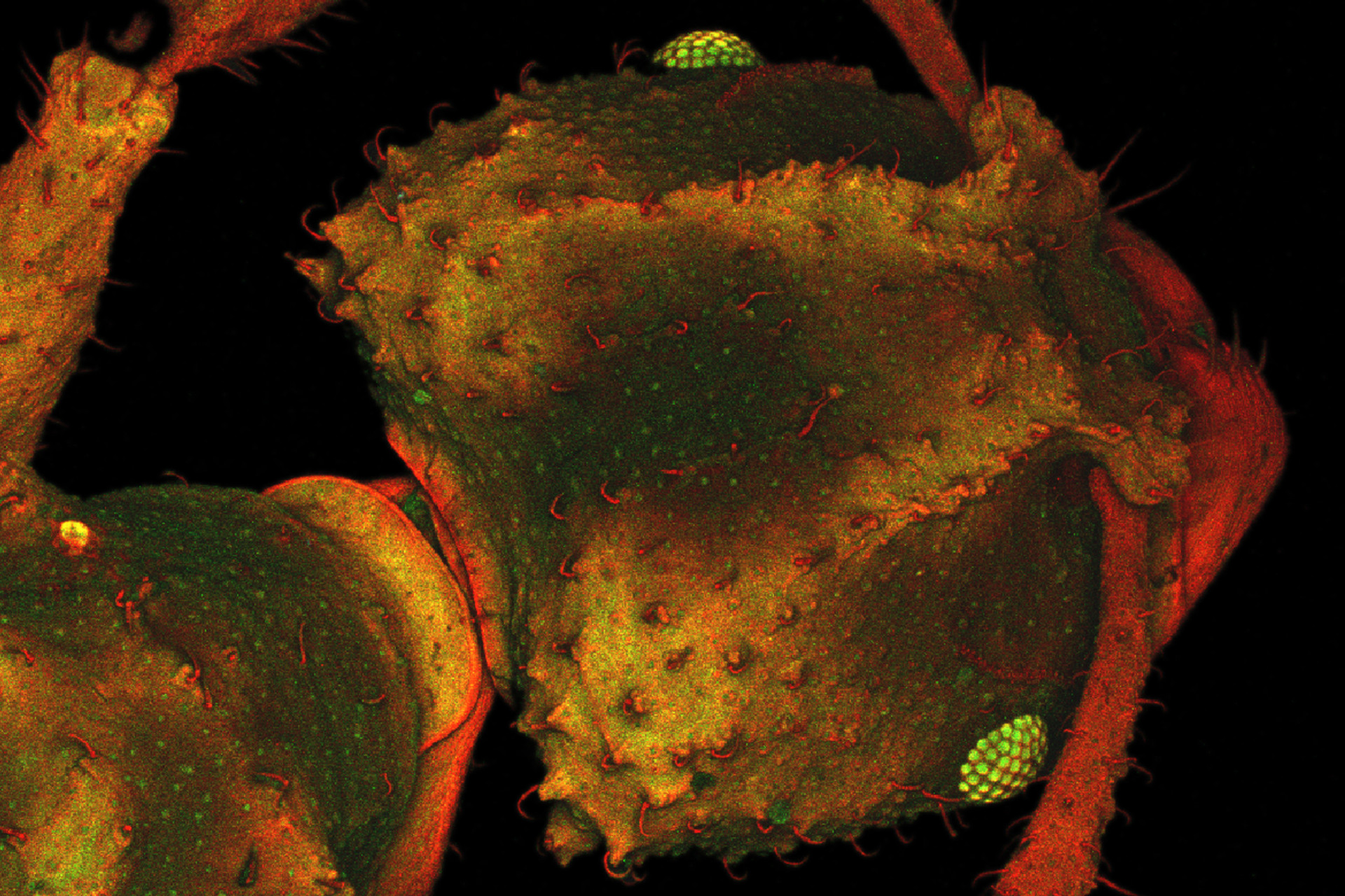 Confocal Microscopy