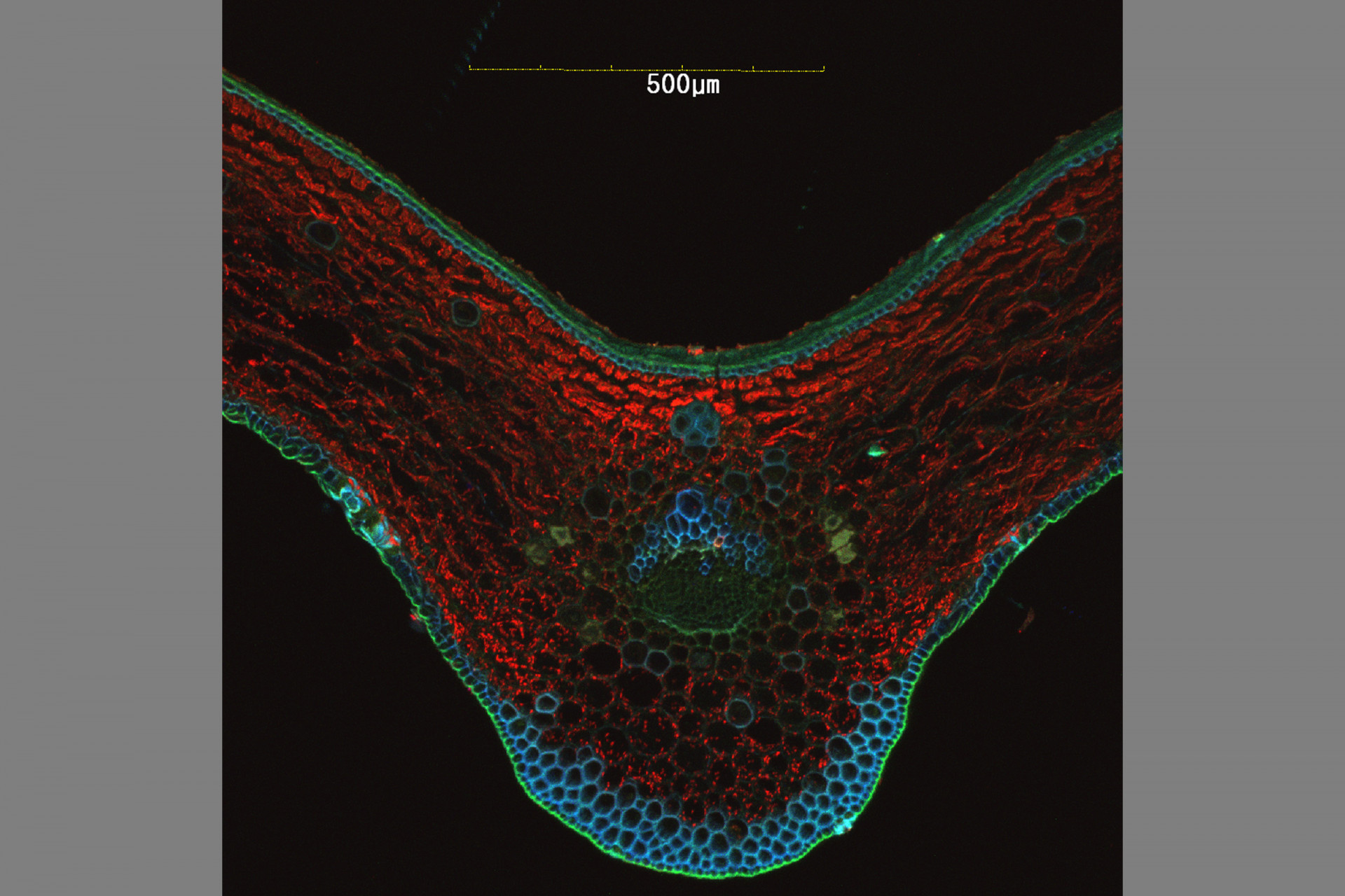 Confocal Microscopy