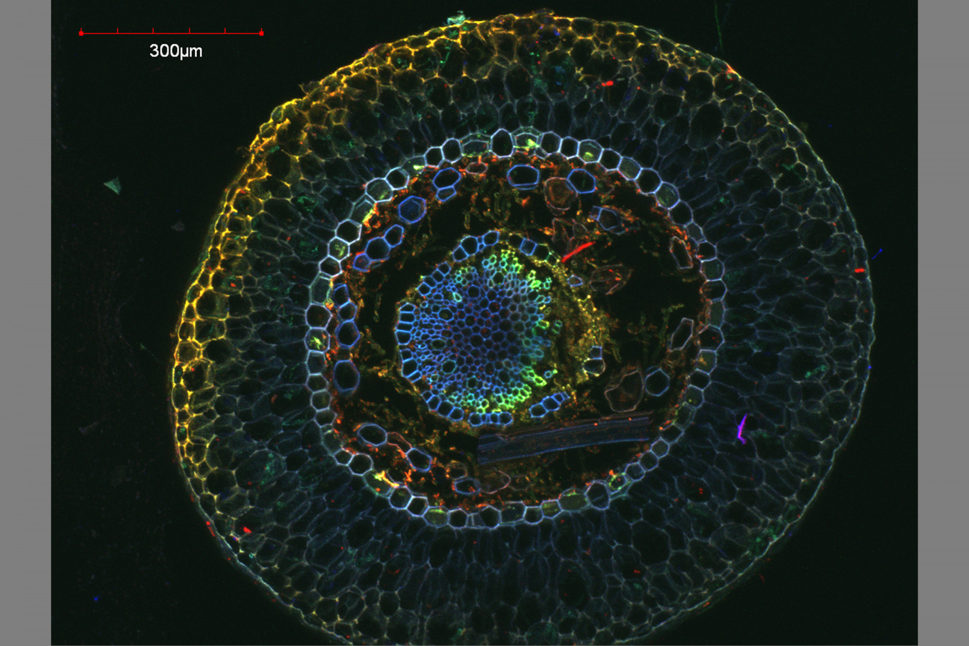 Confocal Microscopy