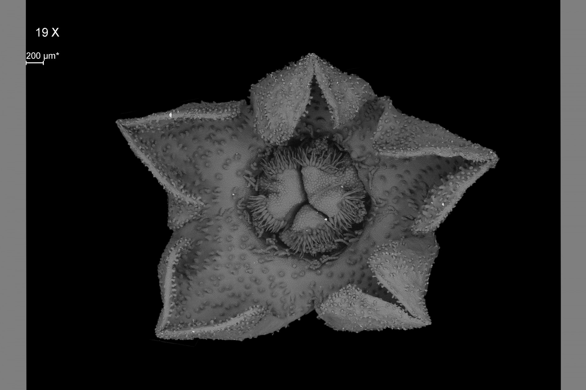 Electron Microscopy