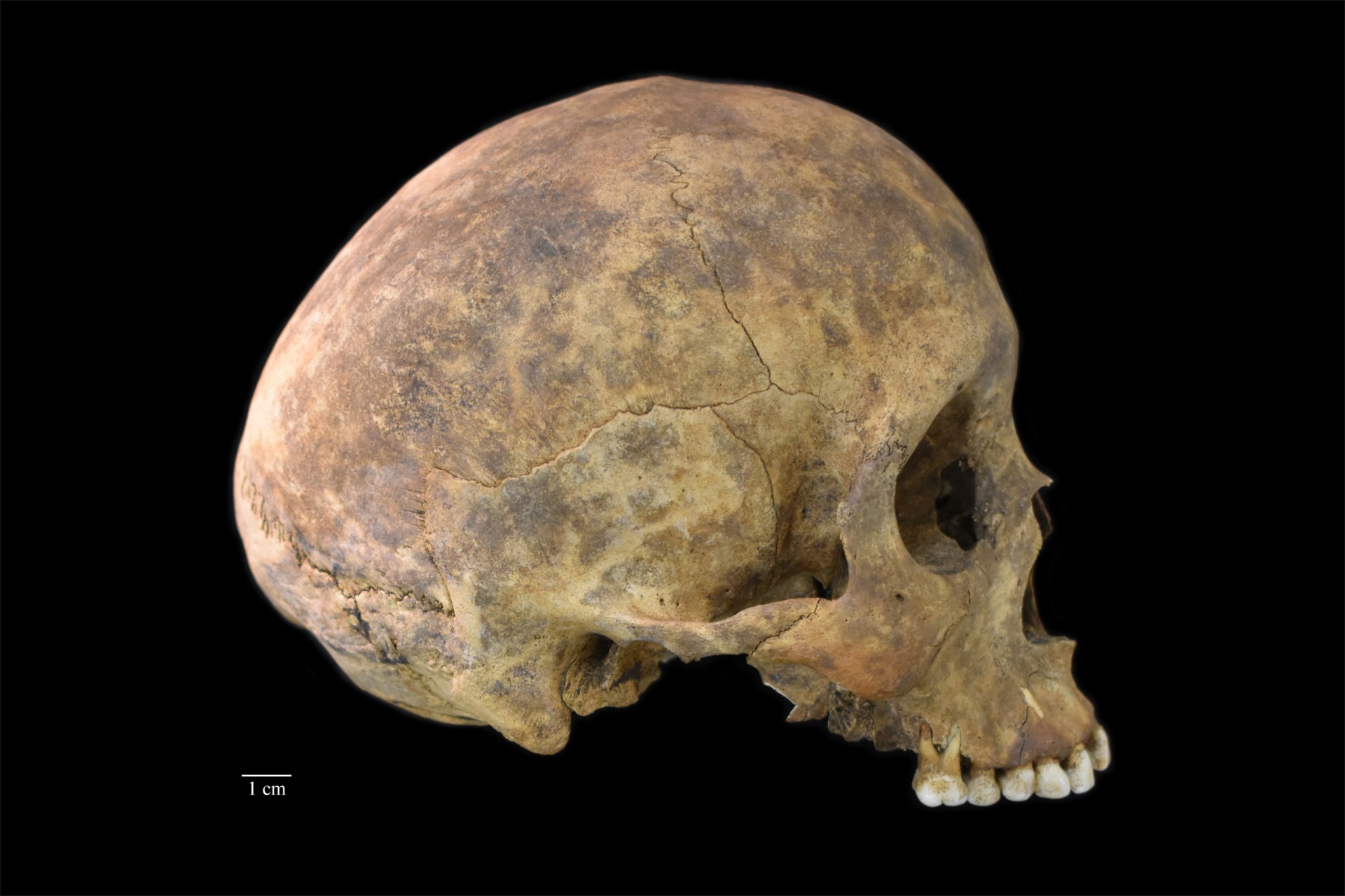 Pre-Columbian burials