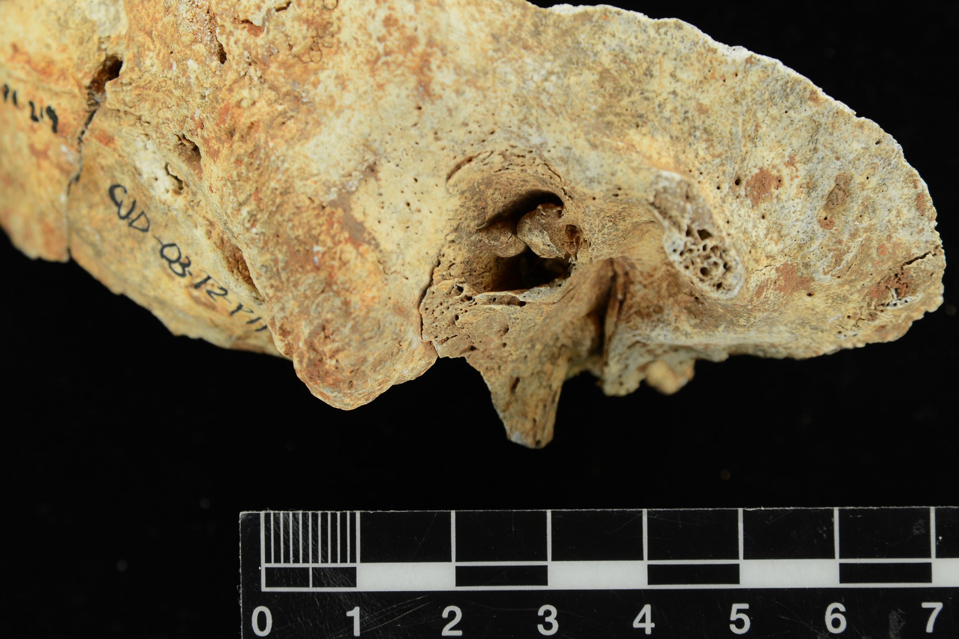 Surfer’s Ear Points to Ancient Pearl Divers in Panama