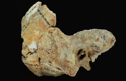 Surfer’s Ear Points to Ancient Pearl Divers in Panama